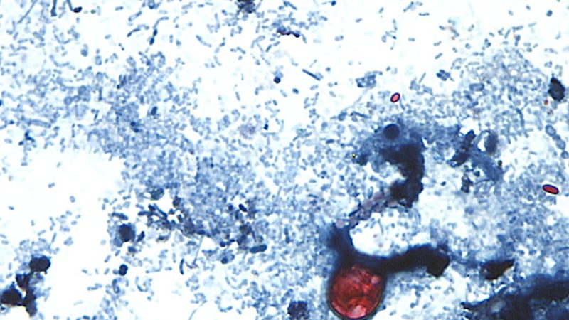 En esta imagen sin fecha, tomada a través de un microscopio y proporcionada por los Centros...
